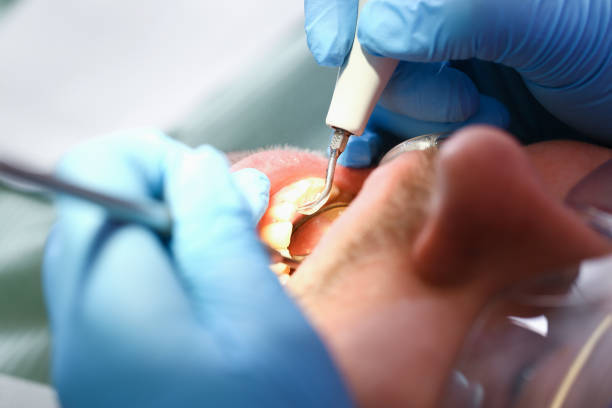 Best Urgent Dental Care for Toothaches in Vinings, GA